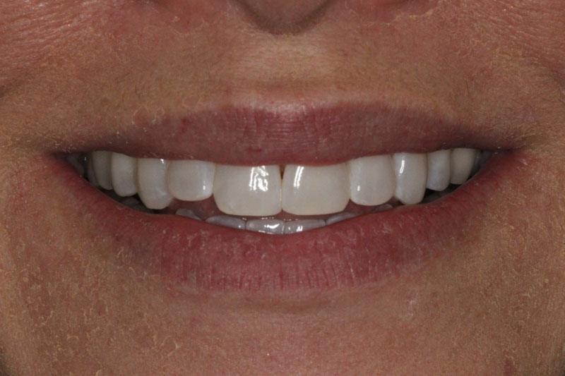 SoCalSmiles Dental Office SoCalSmiles Dental Office
