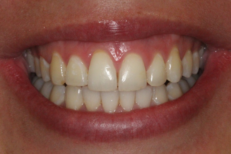 SoCalSmiles Dental Office SoCalSmiles Dental Office
