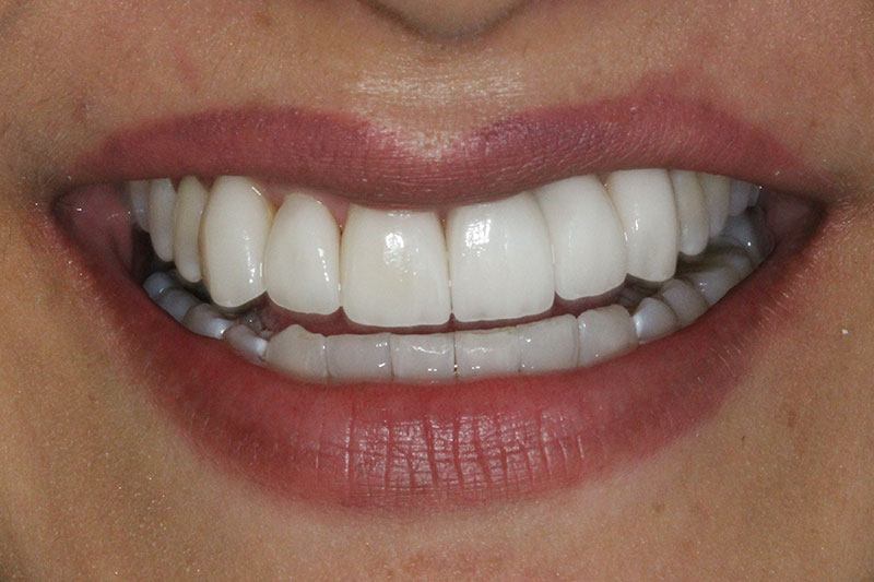 SoCalSmiles Dental Office SoCalSmiles Dental Office