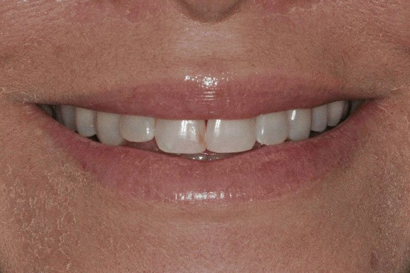 SoCalSmiles Dental Office SoCalSmiles Dental Office