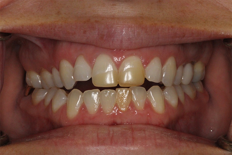SoCalSmiles Dental Office SoCalSmiles Dental Office