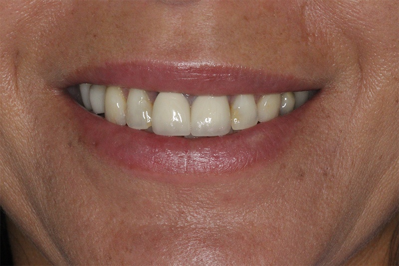 SoCalSmiles Dental Office SoCalSmiles Dental Office