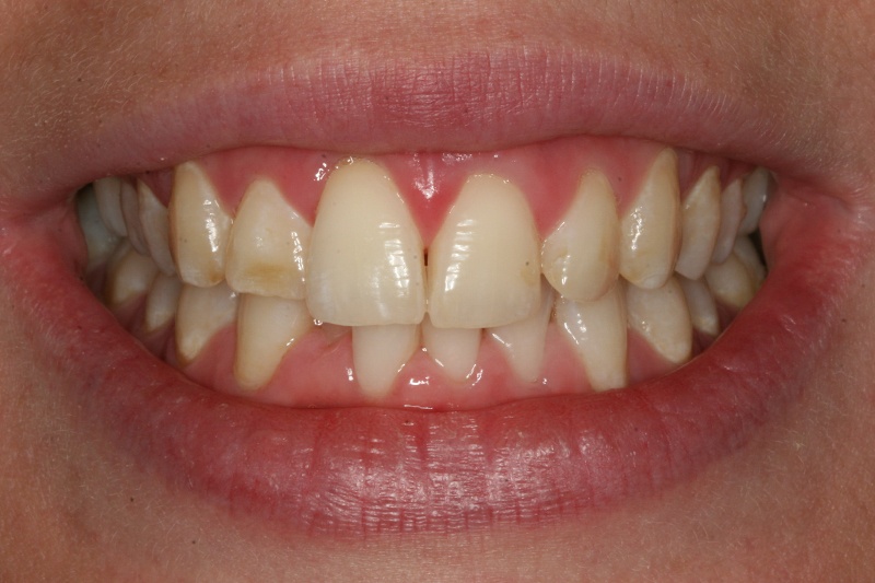 SoCalSmiles Dental Office SoCalSmiles Dental Office