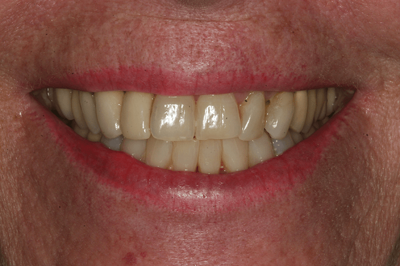 SoCalSmiles Dental Office SoCalSmiles Dental Office