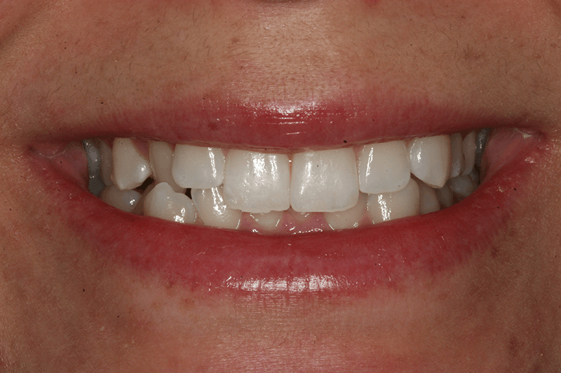 SoCalSmiles Dental Office SoCalSmiles Dental Office