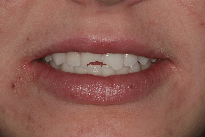SoCalSmiles Dental Office SoCalSmiles Dental Office