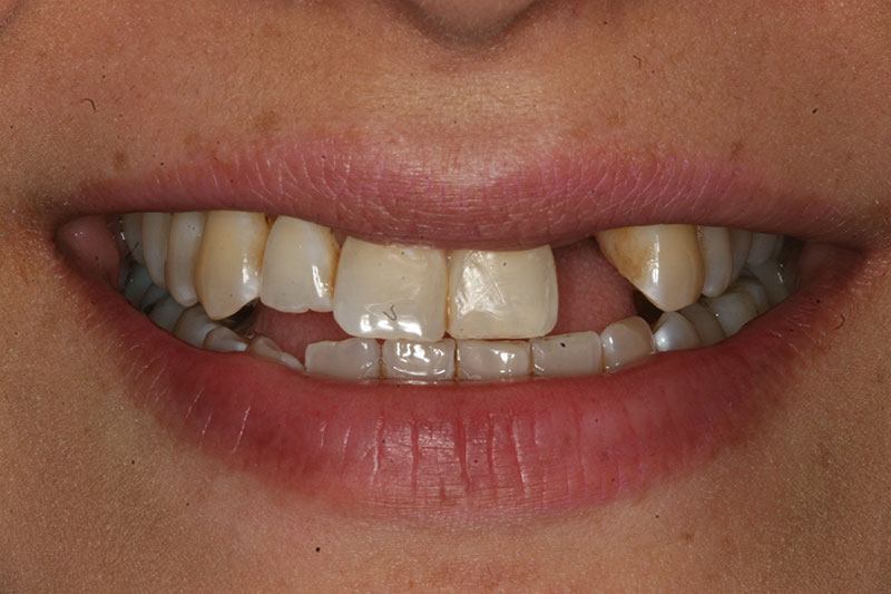 SoCalSmiles Dental Office SoCalSmiles Dental Office